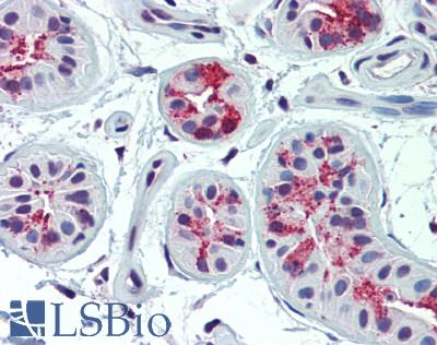 SLC5A5 / NIS Antibody - Human Skin, Sweat Glands: Formalin-Fixed, Paraffin-Embedded (FFPE)