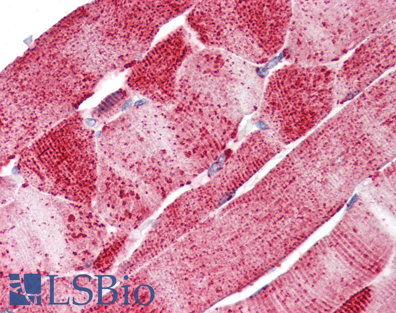 SLC5A6 / SMVT Antibody - Anti-SLC5A6 antibody IHC of human skeletal muscle. Immunohistochemistry of formalin-fixed, paraffin-embedded tissue after heat-induced antigen retrieval.