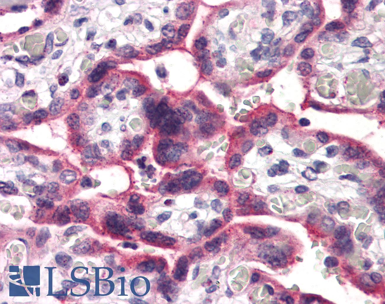SLC5A6 / SMVT Antibody - Anti-SLC5A6 antibody IHC of human placenta. Immunohistochemistry of formalin-fixed, paraffin-embedded tissue after heat-induced antigen retrieval.