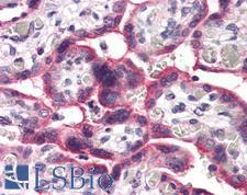 SLC5A6 / SMVT Antibody - Anti-SLC5A6 antibody IHC of human placenta. Immunohistochemistry of formalin-fixed, paraffin-embedded tissue after heat-induced antigen retrieval.