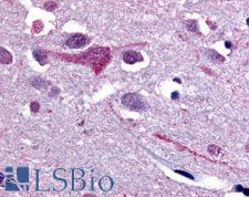 SLC5A9 / SGLT4 Antibody - Anti-SLC5A9 antibody IHC of human brain, cortex. Immunohistochemistry of formalin-fixed, paraffin-embedded tissue after heat-induced antigen retrieval.