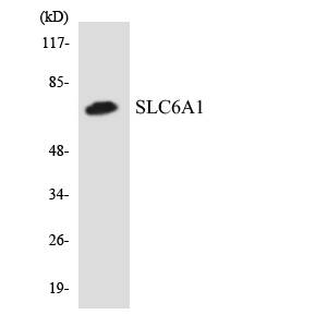 SLC6A1 / GAT-1 Antibody - Western blot of the lysates from HeLa cells using SLC6A1 antibody.