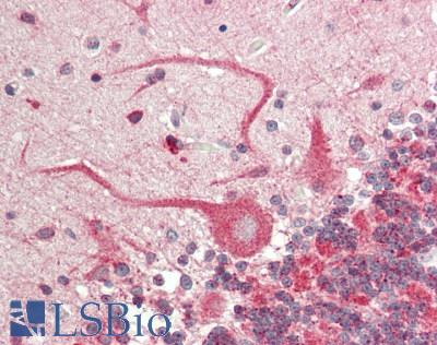 SLC6A1 / GAT-1 Antibody - Human Brain, Cerebellum: Formalin-Fixed, Paraffin-Embedded (FFPE)