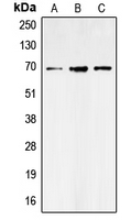 SLC6A1 / GAT-1 Antibody - Western blot analysis of GAT1 expression in SHSY5Y (A); NIH3T3 (B); rat brain (C) whole cell lysates.