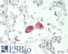 SLC6A1 / GAT-1 Antibody - Human Small Intestine, Ganglion Cells: Formalin-Fixed, Paraffin-Embedded (FFPE)