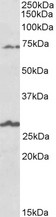 SLC6A12 / BGT-1 Antibody - SLC6A12 antibody (1 ug/ml) staining of Human Olfactory bulb lysate (35 ug protein in RIPA buffer). Primary incubation was 1 hour. Detected by chemiluminescence.