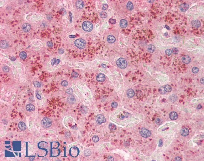 SLC6A12 / BGT-1 Antibody - Anti-SLC6A12 / BGT-1 antibody IHC staining of human liver. Immunohistochemistry of formalin-fixed, paraffin-embedded tissue after heat-induced antigen retrieval. Antibody concentration 10 ug/ml.