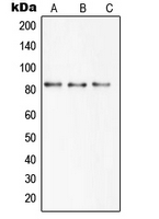 SLC6A15 / SBAT1 Antibody - Western blot analysis of SBAT1 expression in HEK293T (A); mouse brain (B); rat brain (C) whole cell lysates.