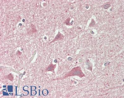 SLC6A15 / SBAT1 Antibody - Human Brain, Cortex: Formalin-Fixed, Paraffin-Embedded (FFPE)