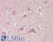 SLC6A15 / SBAT1 Antibody - Human Brain, Cortex: Formalin-Fixed, Paraffin-Embedded (FFPE)