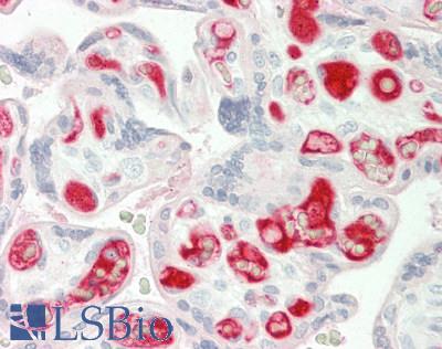 SLC6A8 Antibody - Human Placenta: Formalin-Fixed, Paraffin-Embedded (FFPE)