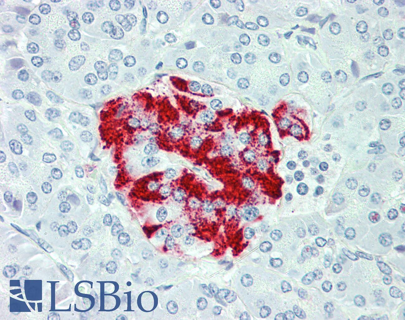 SLC7A2 Antibody - Anti-SLC7A2 antibody IHC of human pancreas. Immunohistochemistry of formalin-fixed, paraffin-embedded tissue after heat-induced antigen retrieval.