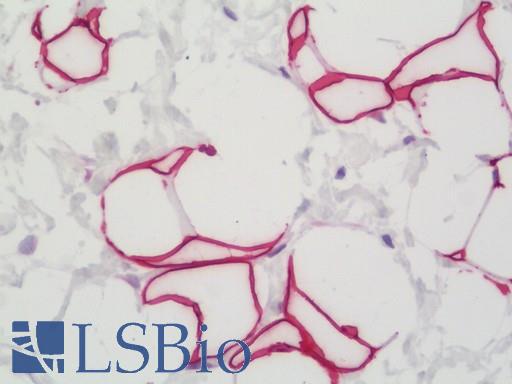 SLC7A5 / CD98 Light Chain Antibody - Human Breast: Formalin-Fixed, Paraffin-Embedded (FFPE)