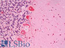 SLC7A6 Antibody - Human Cerebellum: Formalin-Fixed, Paraffin-Embedded (FFPE)