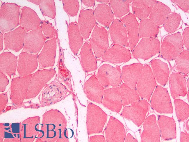 SLC7A6 Antibody - Human Skeletal Muscle: Formalin-Fixed, Paraffin-Embedded (FFPE)