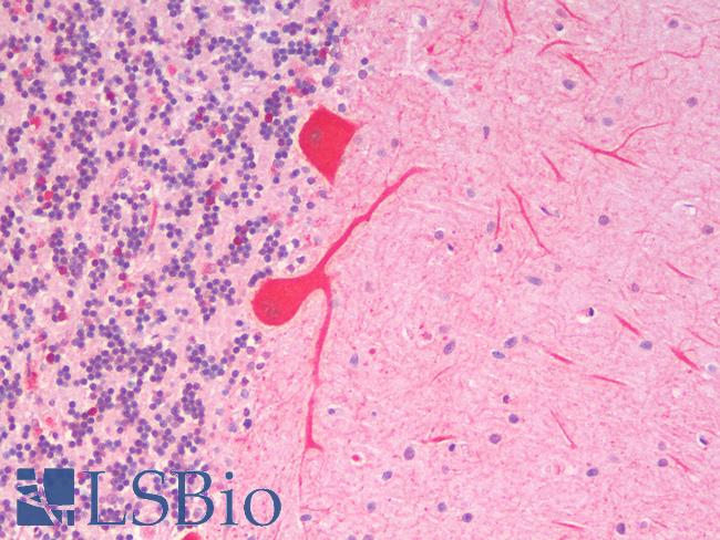 SLC7A6 Antibody - Human Cerebellum: Formalin-Fixed, Paraffin-Embedded (FFPE)