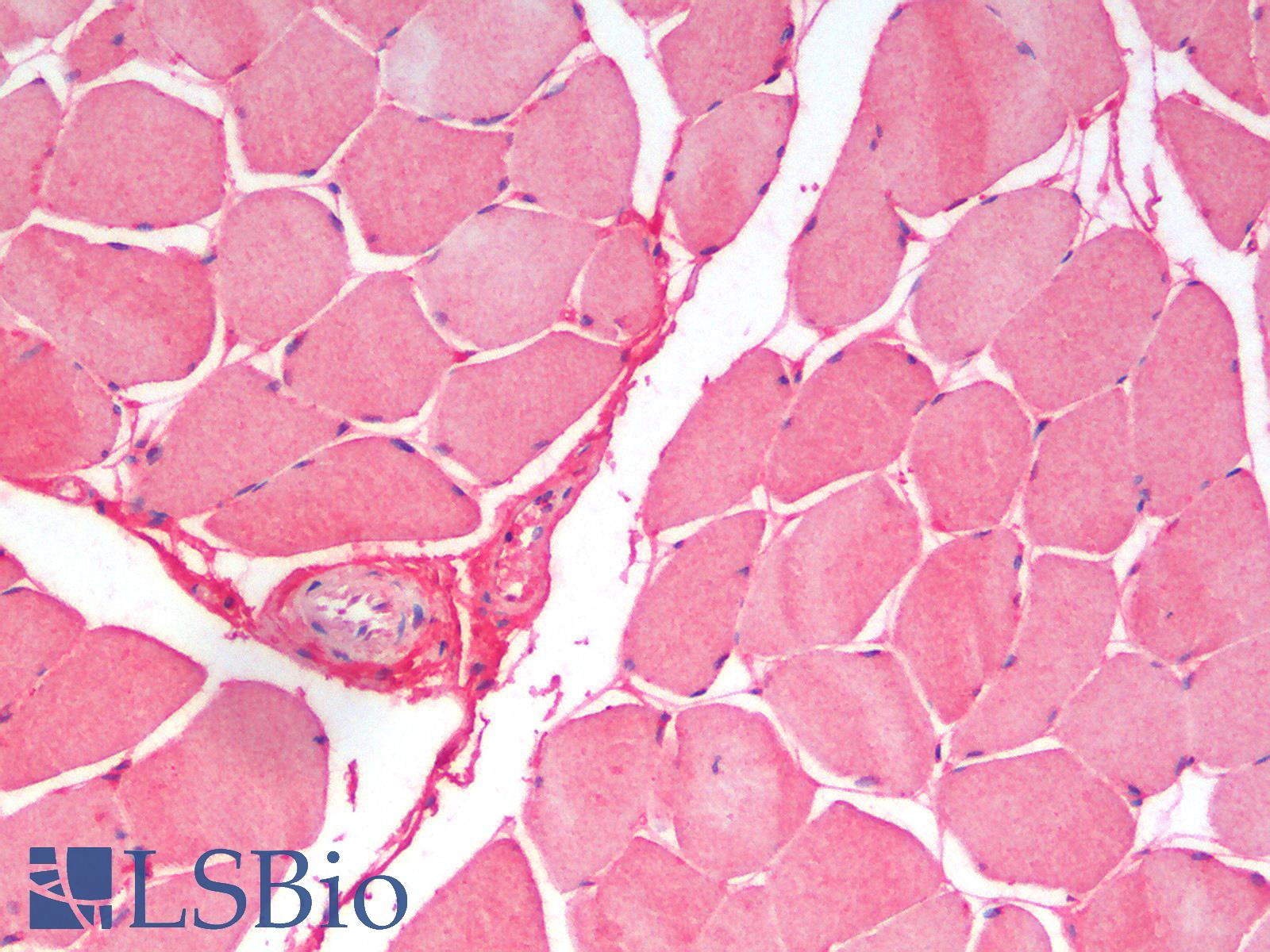 SLC7A6 Antibody - Human Skeletal Muscle: Formalin-Fixed, Paraffin-Embedded (FFPE)