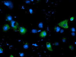 SLC7A8 / LAT2 Antibody - Anti-SLC7A8 mouse monoclonal antibody immunofluorescent staining of COS7 cells transiently transfected by pCMV6-ENTRY SLC7A8.