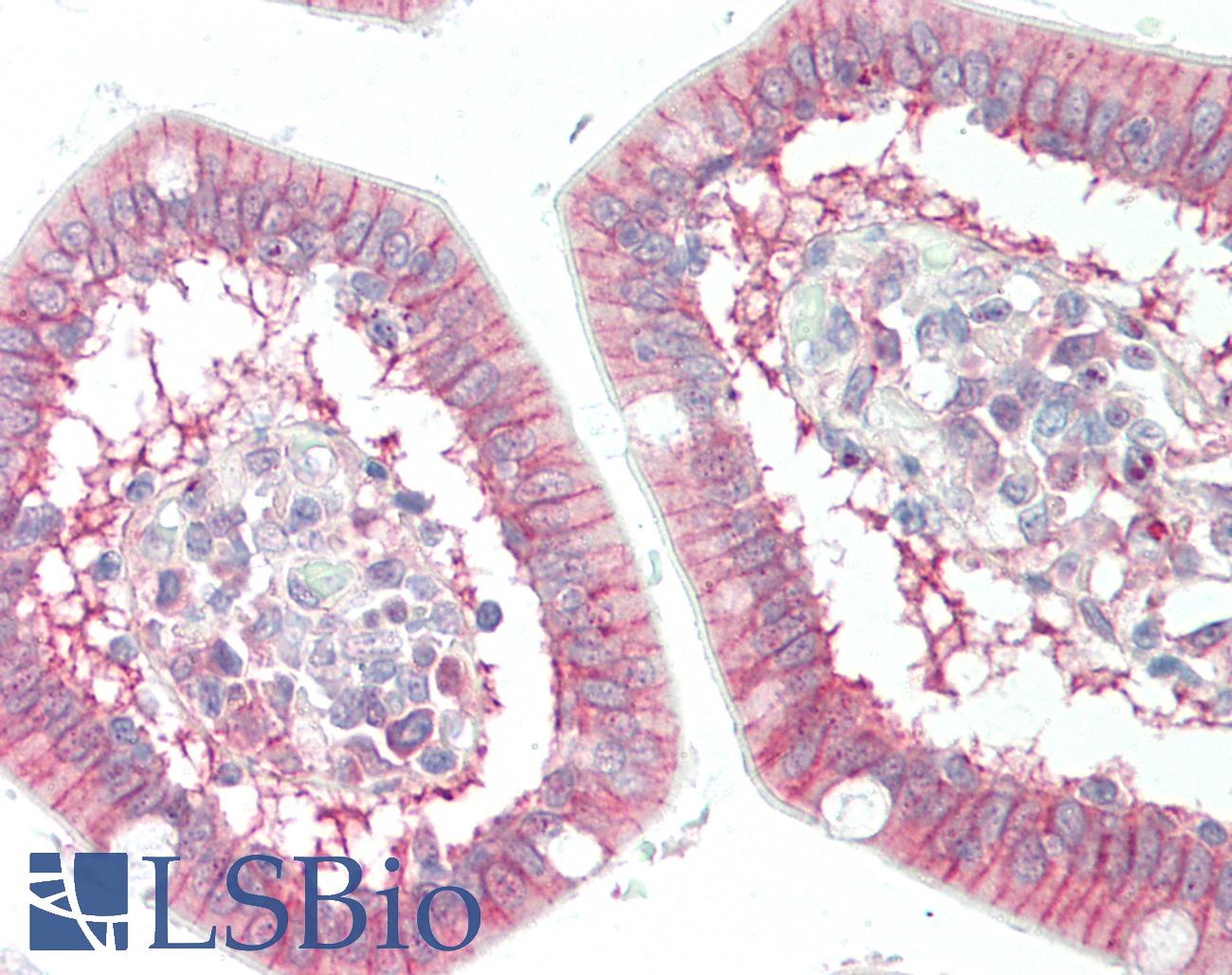 SLC7A8 / LAT2 Antibody - Human Small Intestine: Formalin-Fixed, Paraffin-Embedded (FFPE)