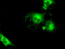 SLC7A8 / LAT2 Antibody - Anti-SLC7A8 mouse monoclonal antibody  immunofluorescent staining of COS7 cells transiently transfected by pCMV6-ENTRY SLC7A8.
