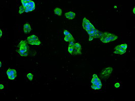 SLC7A8 / LAT2 Antibody - Immunofluorescent staining of HepG2 cells using anti-SLC7A8 mouse monoclonal antibody.