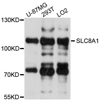 SLC8A1 / NCX1 Antibody - Western blot analysis of extracts of various cells.