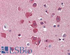 SLC8A3 / NCX3 Antibody - Human Brain, Cortex: Formalin-Fixed, Paraffin-Embedded (FFPE), at a concentration of 10 ug/ml. 