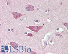 SLC8A3 / NCX3 Antibody - Human Brain, Cortex: Formalin-Fixed, Paraffin-Embedded (FFPE),a t a concentration of 10 ug/ml. 
