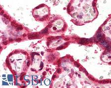 SLC9A3R1 / NHERF1 / EBP50 Antibody - Anti-SLC9A3R1 / NHERF1 antibody IHC of human placenta. Immunohistochemistry of formalin-fixed, paraffin-embedded tissue after heat-induced antigen retrieval. Antibody concentration 5 ug/ml.