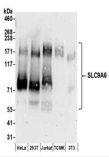 SLC9A6 Antibody - Detection of Human and Mouse SLC9A6 by Western Blot. Samples: Whole cell lysate (50 ug) prepared using NETN buffer from HeLa, 293T, Jurkat, mouse TCMK-1, and mouse NIH3T3 cells. Antibodies: Affinity purified rabbit anti-SLC9A6 antibody used for WB at 0.1 ug/ml. Detection: Chemiluminescence with an exposure time of 30 seconds.