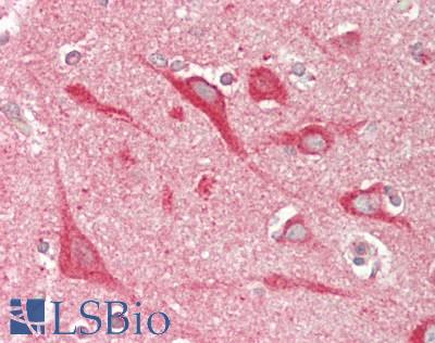 SLC9A6 Antibody - Human Brain, Cortex: Formalin-Fixed, Paraffin-Embedded (FFPE)