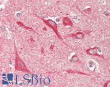 SLC9A6 Antibody - Human Brain, Cortex: Formalin-Fixed, Paraffin-Embedded (FFPE)