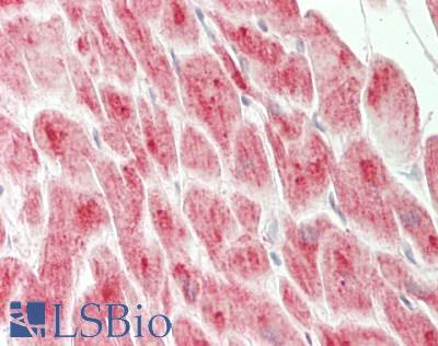 SLC9A6 Antibody - Human Heart: Formalin-Fixed, Paraffin-Embedded (FFPE)