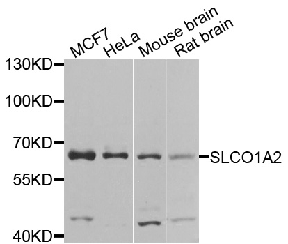 SLCO1A2 / OATP Antibody - Western blot analysis of extracts of various cells.