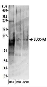 SLCO4A1 / OATP1 Antibody - Detection of Human SLCO4A1 by Western Blot. Samples: Whole cell lysate (50 ug) prepared using NETN buffer from HeLa, 293T, and Jurkat cells. Antibodies: Affinity purified rabbit anti-SLCO4A1 antibody used for WB at 0.1 ug/ml. Detection: Chemiluminescence with an exposure time of 3 minutes.