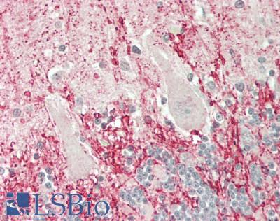 SLCO4A1 / OATP1 Antibody - Human Brain, Cerebellum: Formalin-Fixed, Paraffin-Embedded (FFPE)