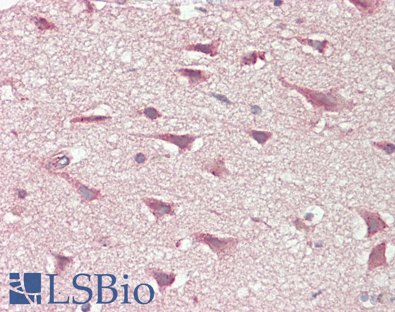 SLCO6A1 / OATP-I Antibody - Anti-SLCO6A1 / OATP-I antibody IHC staining of human brain, cortex. Immunohistochemistry of formalin-fixed, paraffin-embedded tissue after heat-induced antigen retrieval. Antibody dilution 1:100.