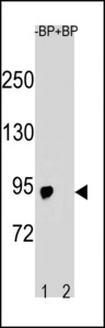 SLCO6A1 / OATP-I Antibody - Western blot of SLCO6A1 Antibody antibody pre-incubated without(lane 1) and with(lane 2) blocking peptide in A2058 cell line lysate. SLCO6A1 Antibody (arrow) was detected using the purified antibody.