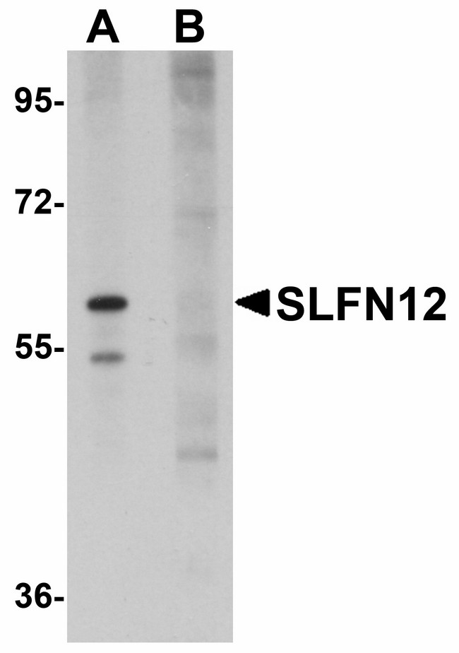 SLFN12 Antibody - Western blot of SLFN12 in SK-N-SH cell lysate with SLFN12 antibody at 1 ug/ml in (A) the absence and (B) the presence of blocking peptide.