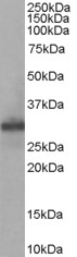 SLIM / FHL1 Antibody - Antibody staining (0.05 ug/ml) of Human Muscle lysate (RIPA buffer, 35 ug total protein per lane). Primary incubated for 1 hour. Detected by Western blot of chemiluminescence.