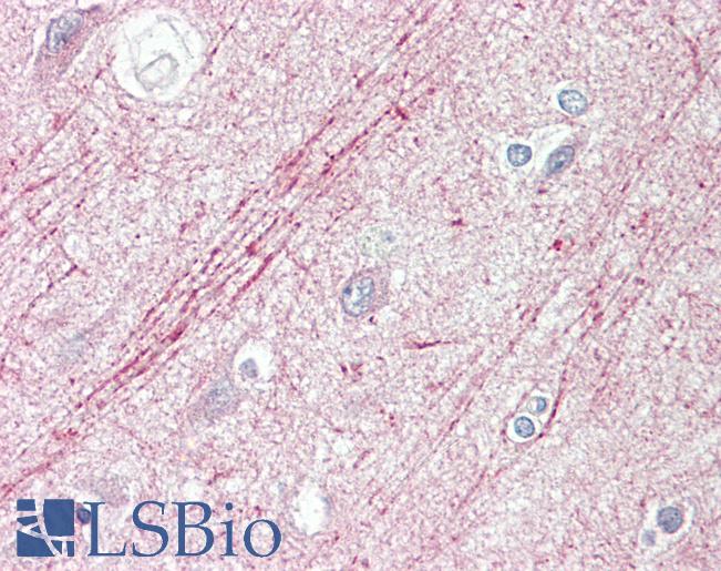 SLIT1 Antibody - Anti-SLIT1 / SLIT-1 antibody IHC staining of human brain, cortex. Immunohistochemistry of formalin-fixed, paraffin-embedded tissue after heat-induced antigen retrieval.