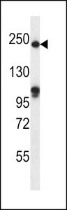 SLIT1 Antibody - SLIT1 Antibody western blot of mouse heart tissue lysates (35 ug/lane). The SLIT1 antibody detected the SLIT1 protein (arrow).