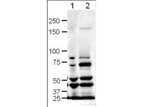 SLIT1 Antibody - Anti-SLIT-1 Antibody - Western Blot. Western blot of Affinity Purified anti-SLIT-1 antibody shows detection of SLIT-1 in rat (lane 1) and mouse (lane 2) brain lysates. The expected molecular weight for SLIT-1 is 168 kD. Approximately 20 ug of each lysates was run on a SDS-PAGE and transferred onto nitrocellulose followed by reaction with a 1:500 dilution of anti-SLIT-1 antibody. Signal was detected using standard techniques. Note: The smaller strong bands observed in this blot are likely SLIT-1 cleavage products. A number of cleavage products for both Slit1 and Slit2 are reported in the literature resulting from alternate splicing and range from ~40kD -160kD (see Little et al, 2002 (Int J Dev Biol. 2002;46(4):385-91) for additional details regarding SLIT1 alternative splicing).