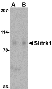 SLITRK1 Antibody - Western blot of Slitrk1 in human brain tissue lysate with Slitrk1 antibody at (A) 1 and (B) 2 ug/ml.