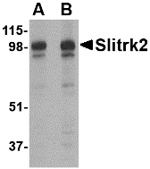 SLITRK2 Antibody - Western blot of Slitrk2 in rat brain tissue lysate with Slitrk2 antibody at (A) 1 and (B) 2 ug/ml.