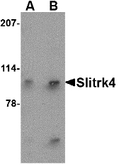 SLITRK4 Antibody - Western blot of Slitrk4 in mouse brain tissue lysate with Slitrk4 antibody at (A) 0.5 and (B) 1 ug/ml.