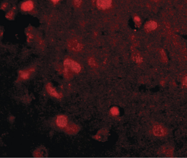 SLITRK4 Antibody - Immunofluorescence of slitrk4 in human brain tissue with slitrk4 antibody at 20 ug/ml.