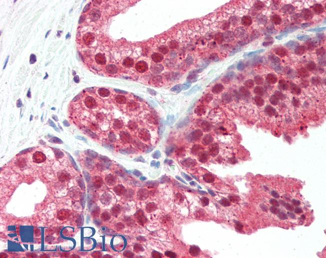 SLITRK4 Antibody - Anti-SLITRK4 antibody IHC of human prostate. Immunohistochemistry of formalin-fixed, paraffin-embedded tissue after heat-induced antigen retrieval. Antibody concentration 5 ug/ml.