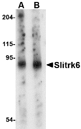 SLITRK6 Antibody - Western blot of Slitrk6 in mouse lung tissue lysate with Slitrk6 antibody at (A) 0.5 and (B) 1 ug/ml.