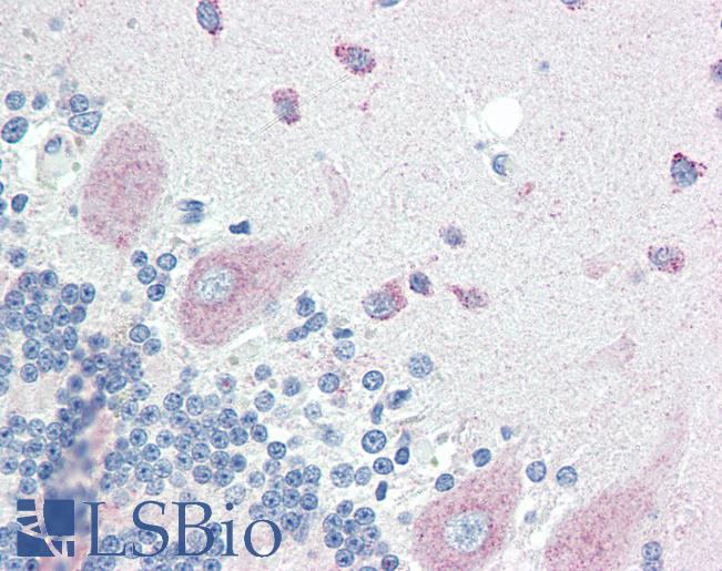 SLITRK6 Antibody - Anti-SLITRK6 antibody IHC of human brain, cerebellum. Immunohistochemistry of formalin-fixed, paraffin-embedded tissue after heat-induced antigen retrieval. Antibody concentration 10 ug/ml.